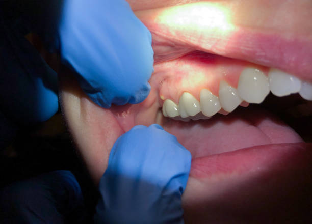 Urgent Tooth Repair in MN