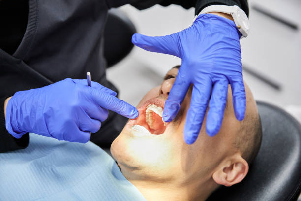 Best Chipped Tooth Repair Near Me  in South St Paul, MN